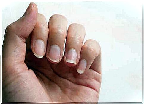 How to strengthen nails naturally: 5 tips