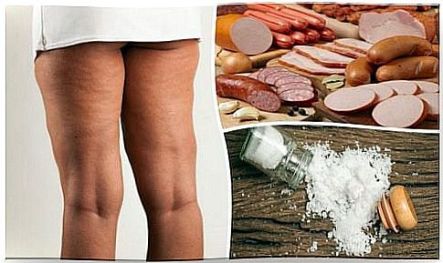 Cellulite - 7 foods that should be avoided to fight it