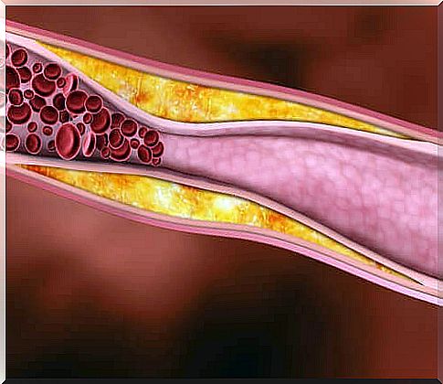 Cholesterol is lowered thanks to 5 healthy fats