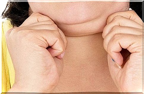 Obese woman - chin