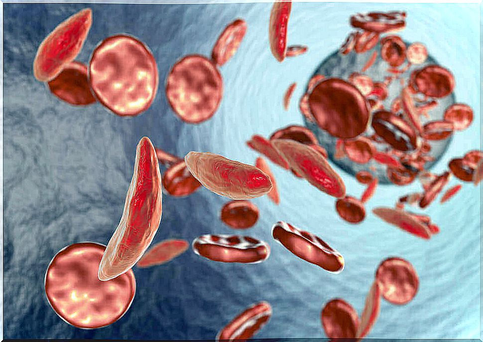 With Fanconi anemia, the body does not make enough red blood cells.