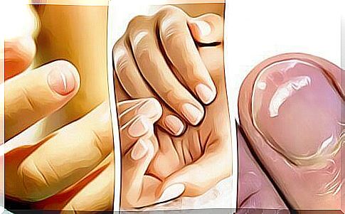 Nails - do you know what they say about your health?