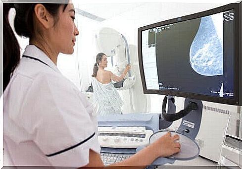 Mammography