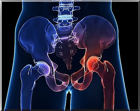 Hip joint degeneration - prophylaxis