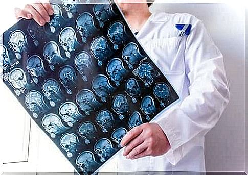 Doctor with brain research results